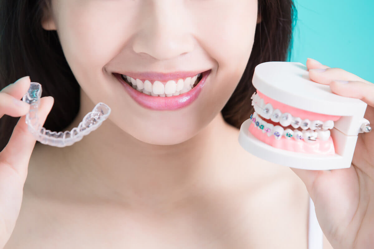 Invisalign clear aligner options