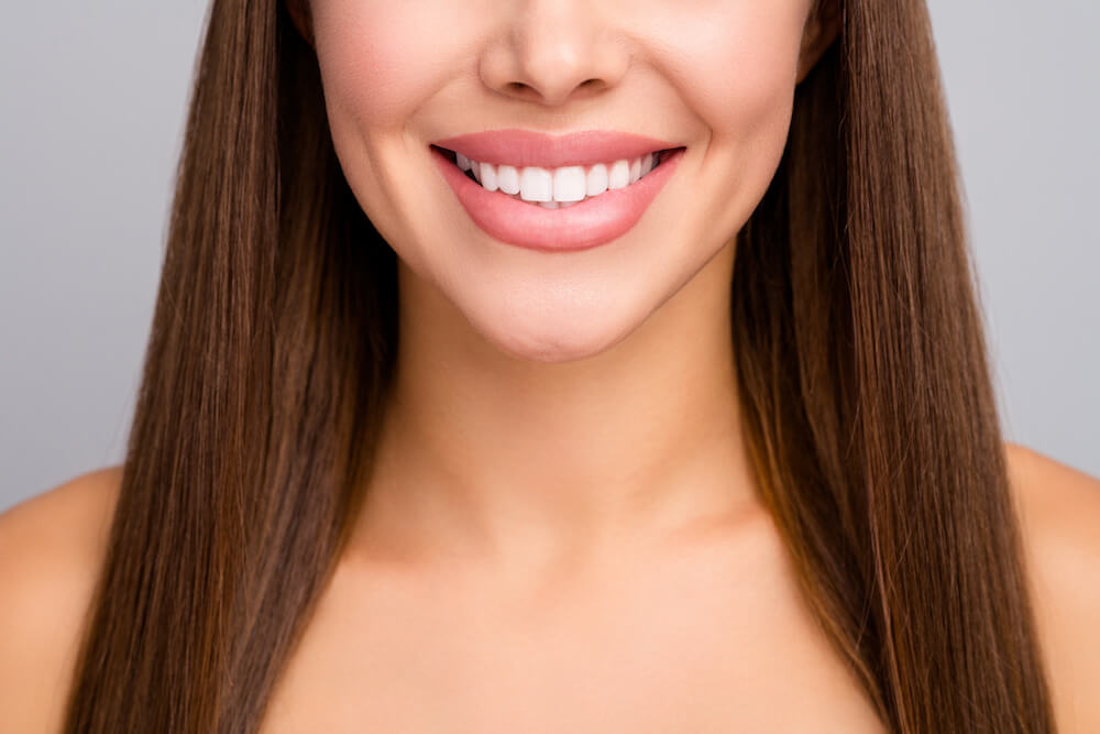 Are Veneers Permanent? Brett Blacher, DDS